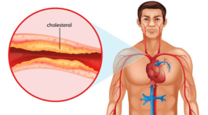 What is Cholesterol